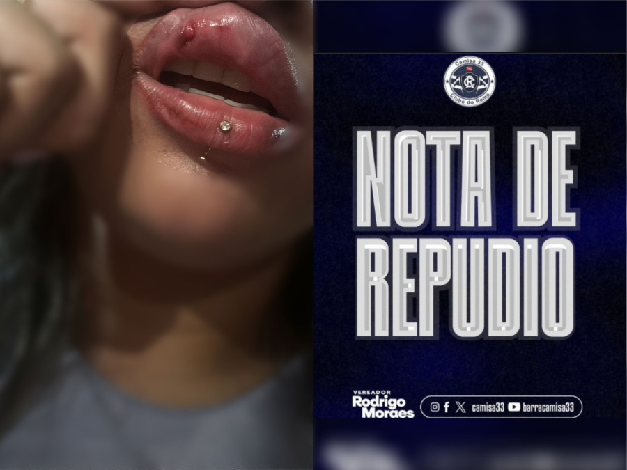 Torcedora é agredida nas arquibancadas do Baenão durante jogo entre Remo e Cruzeiro, clube ainda não se pronunciou sobre o caso