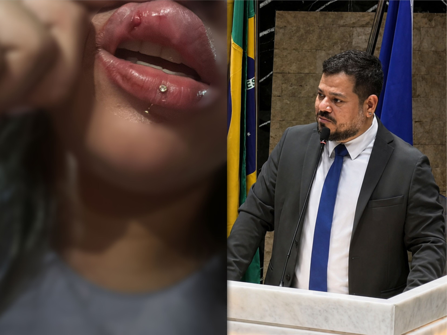 Caso de agressão a torcedora no Baenão repercute na Câmara de Belém e Clube do Remo se pronuncia